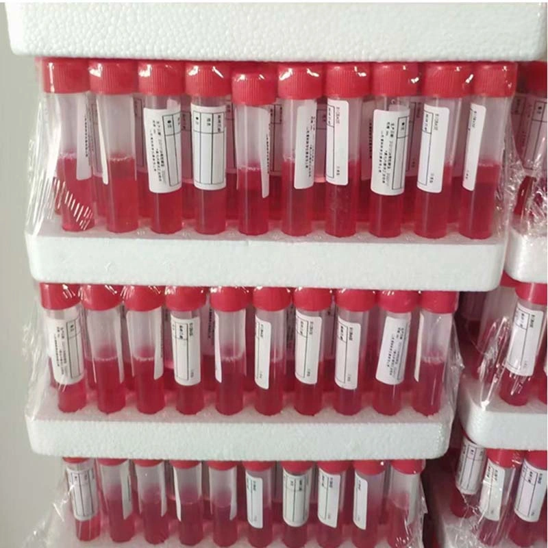 Biobase Cheap Disposable Vtm Sterilized Virus Sampling Tube