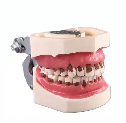 Dental Orthodontics Model Dentistry Study Demonstration Model with Ceramic Brackets 